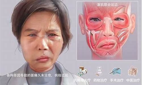 中藥治療神經(jīng)疾病取得突破性進展了嗎？