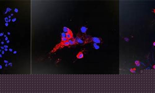 香港大學(xué)微生物系在非典藥物治療研究上有哪些新進(jìn)展？
