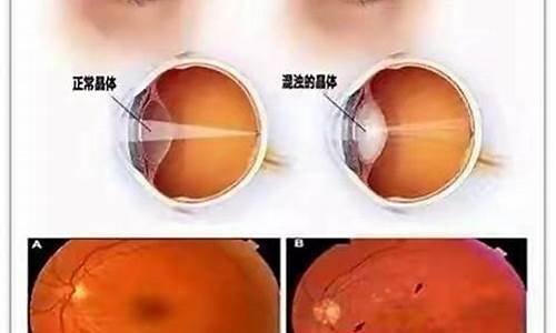 眼睛進化的奧秘究竟是什么？